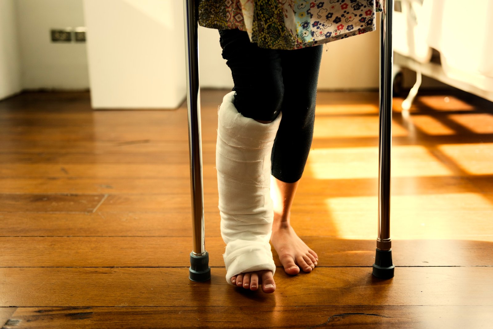 Young Caucasian girl with broken leg in plaster cast